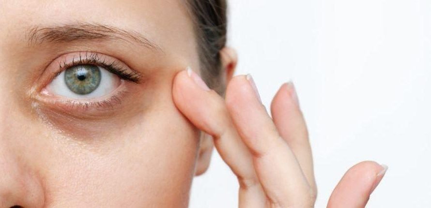 Le traitement des cernes : solutions naturelles et médicales pour un regard éclatant